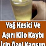 10 kg’a kadar olan asiri kilo