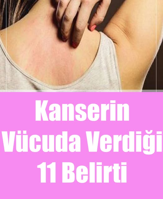 Kanserin Vücuda Verdiği 11 Belirti - Fotoğraf 2